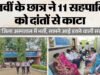 धमतरी के स्कूल में दहशत: एक छात्र ने 11 बच्चों को दांतों से काटा, 24 घंटे निगरानी में बच्चे; जानें पूरा मामला