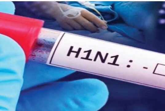 छत्तीसगढ़ में स्वाइन फ्लू की दस्तक: दुर्ग-बिलासपुर में 13 मरीज मिले; अस्पताल अलर्ट पर